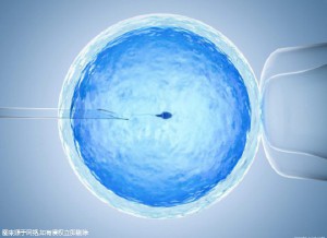 精液分析